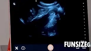 Ultra sound profundity check up on - dr wolf, austin