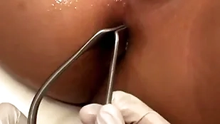 Asian patient penetrated in anal hole by girder in chaplain