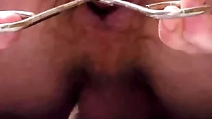 Garden tube enema plus anal distention