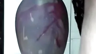 Huge insertion gapes his arse